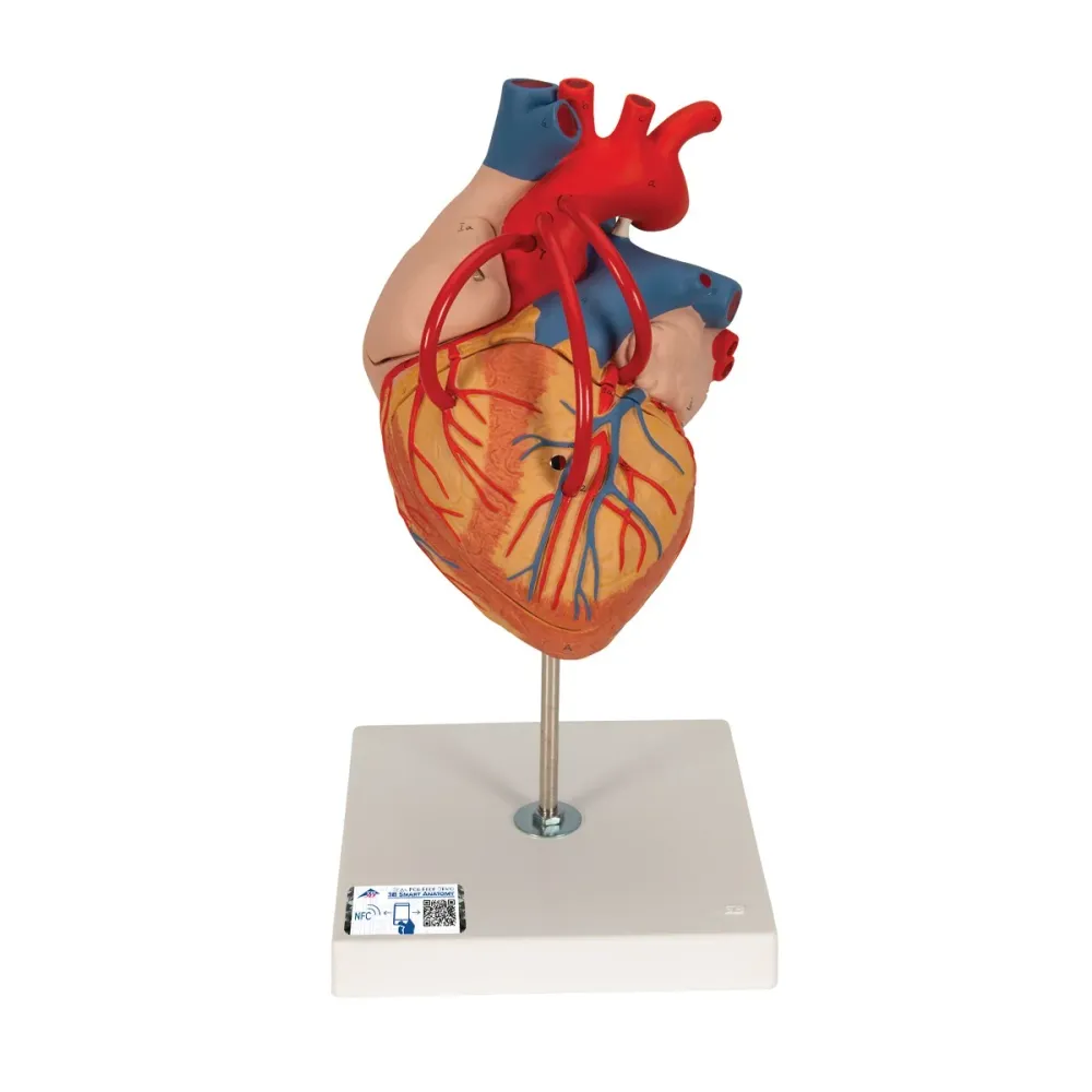 Corazón con bypass, 2 veces el tamaño natural, de 4 piezas - 3B Smart Anatomy 3B Scientific