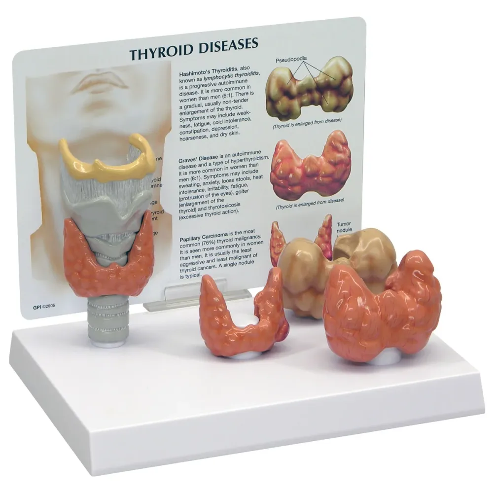 Modelo de tiroides 3B Scientific