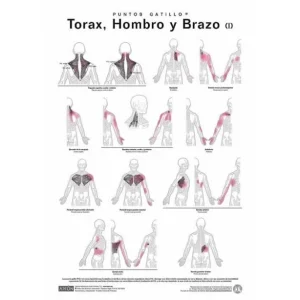 Lamina Puntos Gatillo - Tórax, Hombro y Brazo (I) Axon