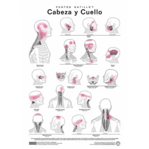Láminas de Puntos Gatillo Axon