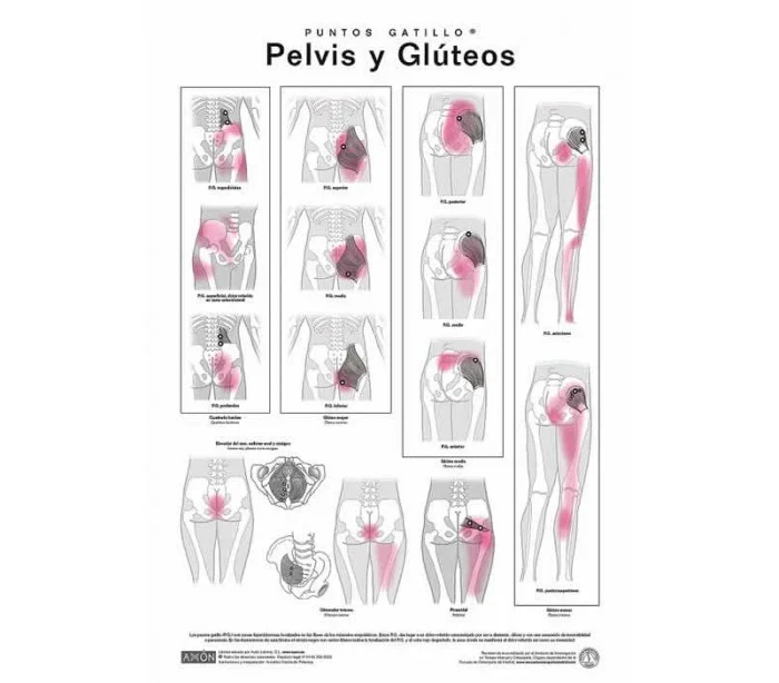 Láminas de Puntos Gatillo Axon